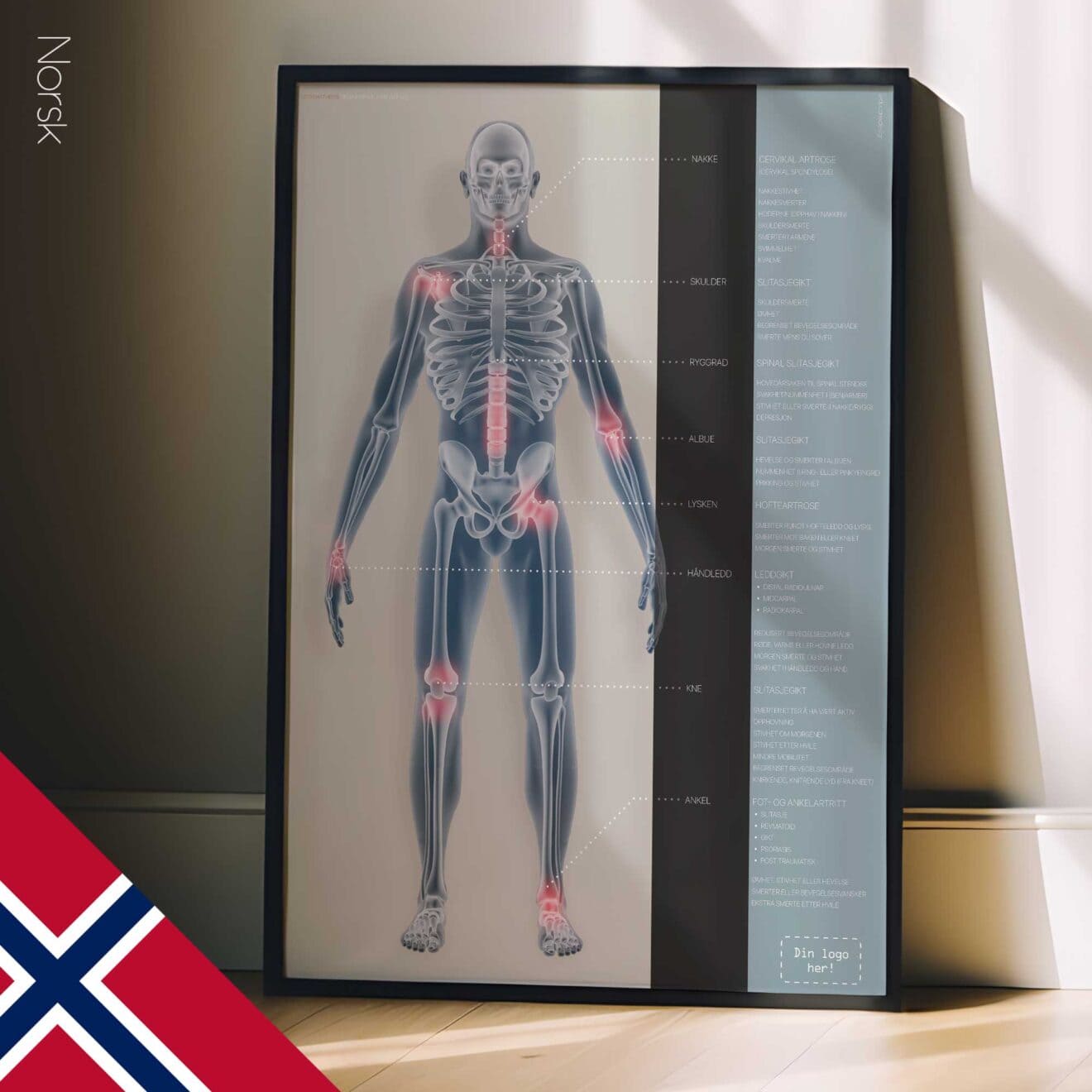 Arthrose. Dessin d'anatomie et de physiologie d'educare.design