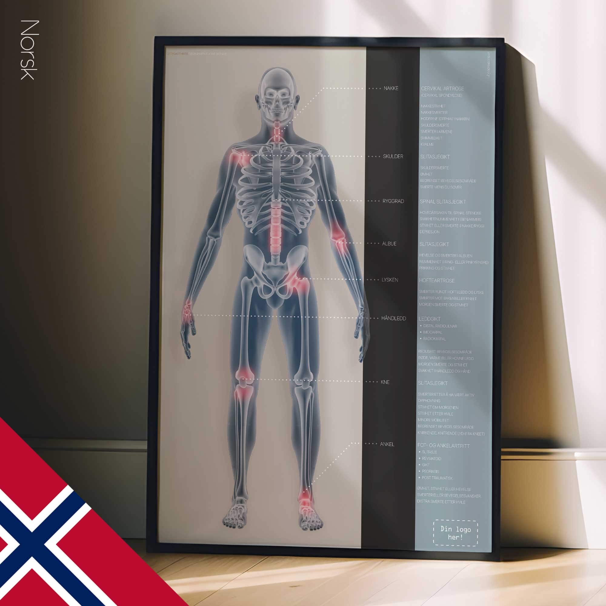 Osteoartrite. Opere d'arte di anatomia e fisiologia da educare.design