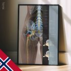 Sciatica and stenosis artwork from educare.design