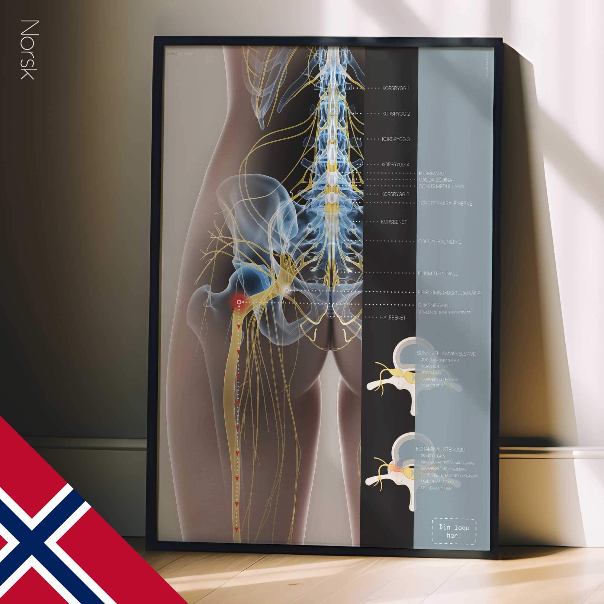 Sciatica and stenosis artwork from educare.design