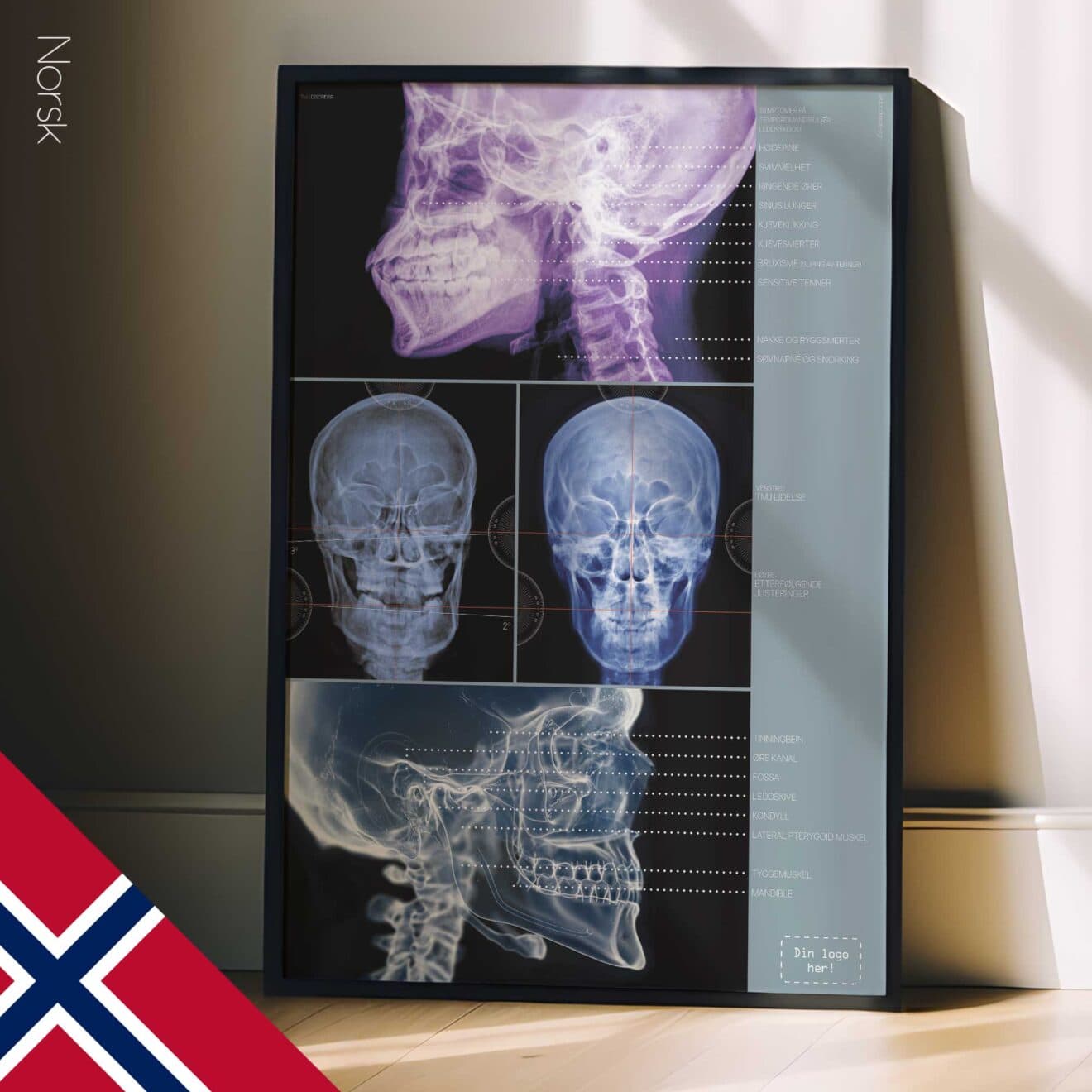 TMJ Disorder. Anatomy and physiology artwork from educare.design