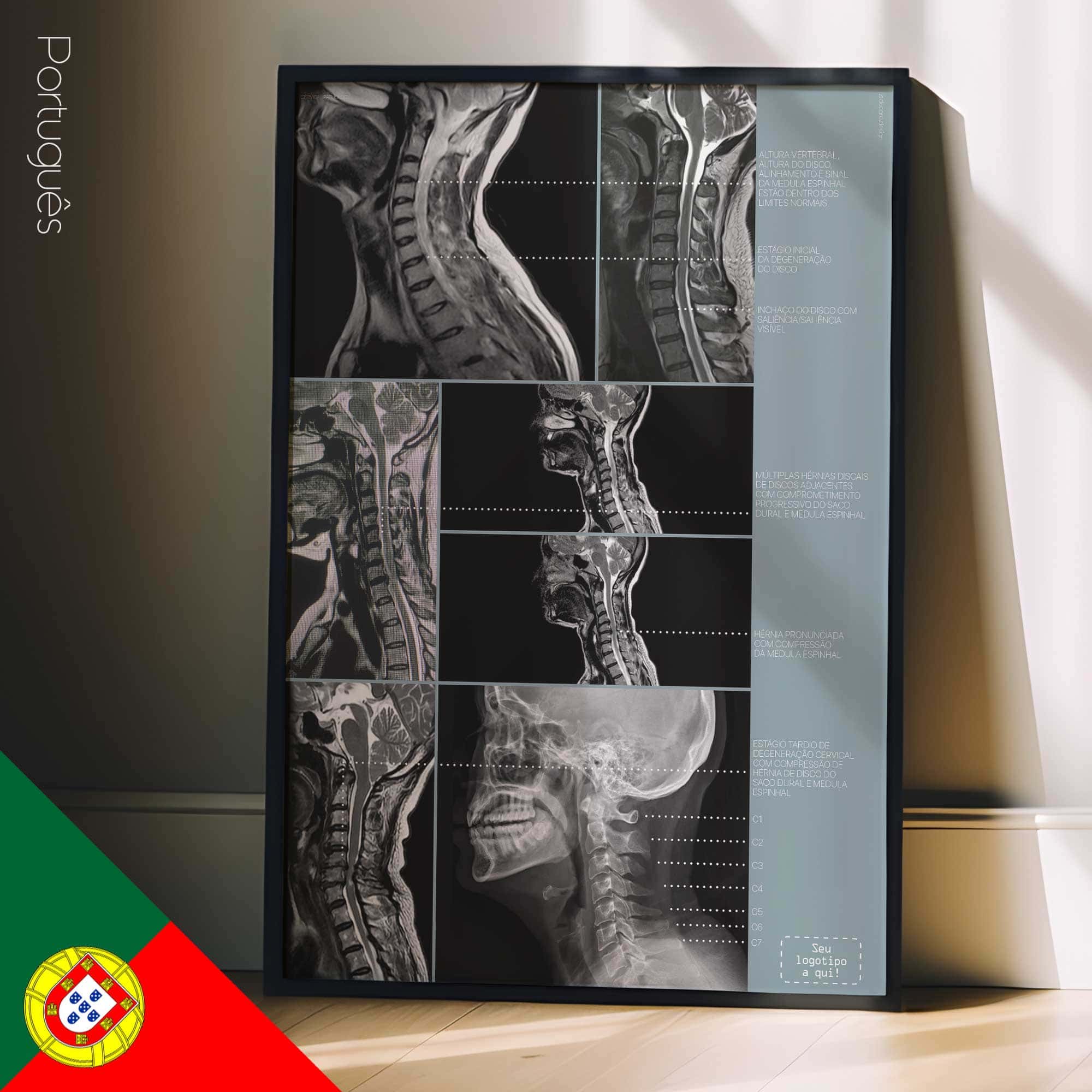 Opere d'arte sulla patologia cervicale da educare.design