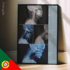 Postura della testa in avanti