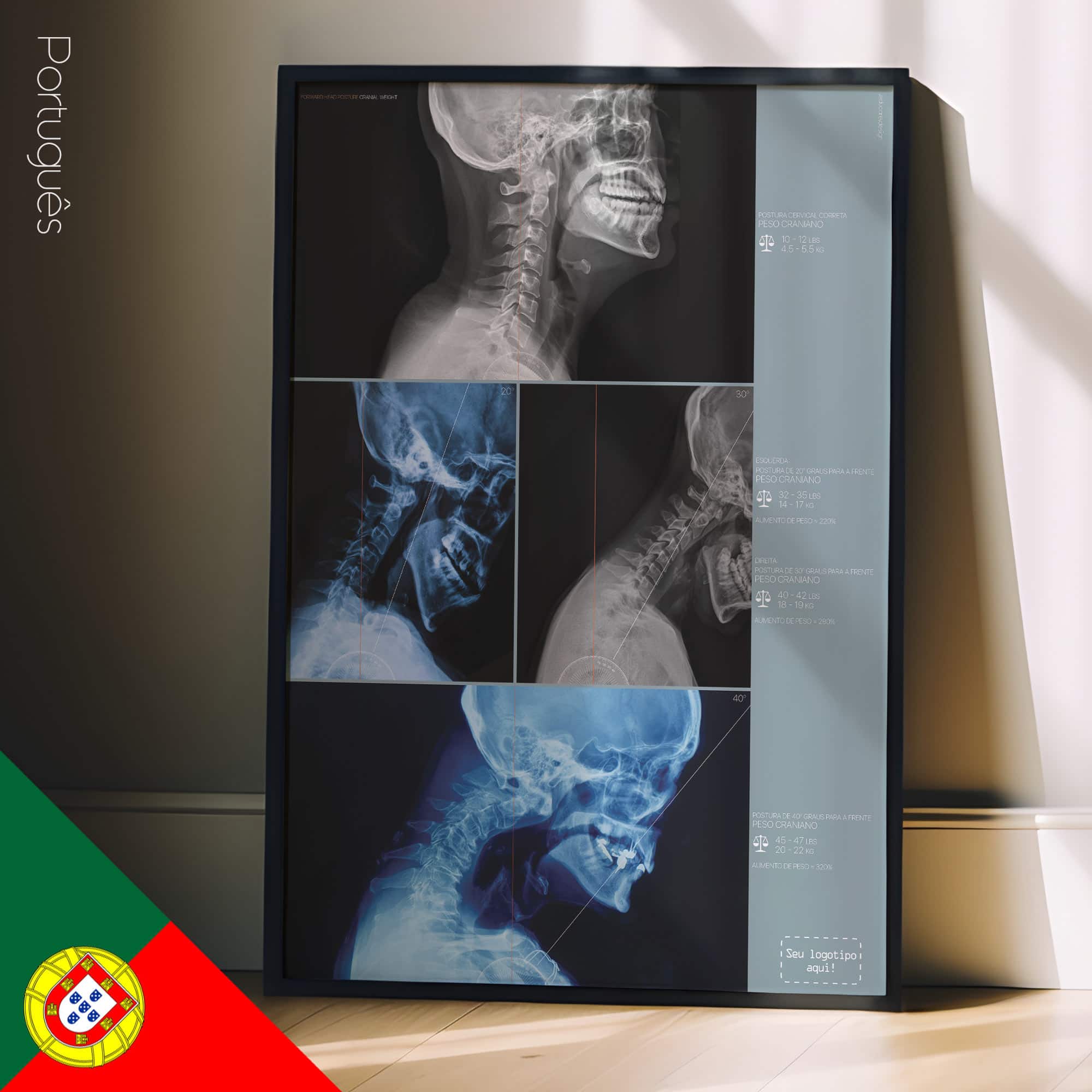 Postura della testa in avanti