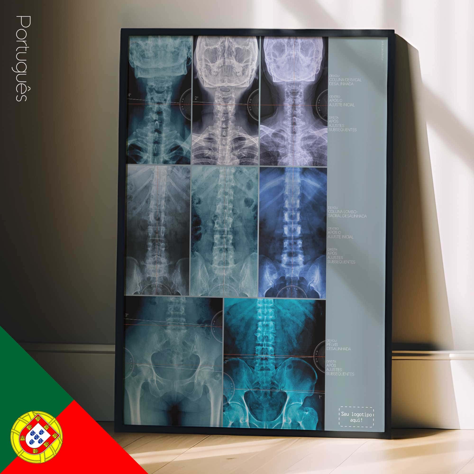 Fehlausrichtung, Anatomie und Physiologie - Kunstwerke von educare.design