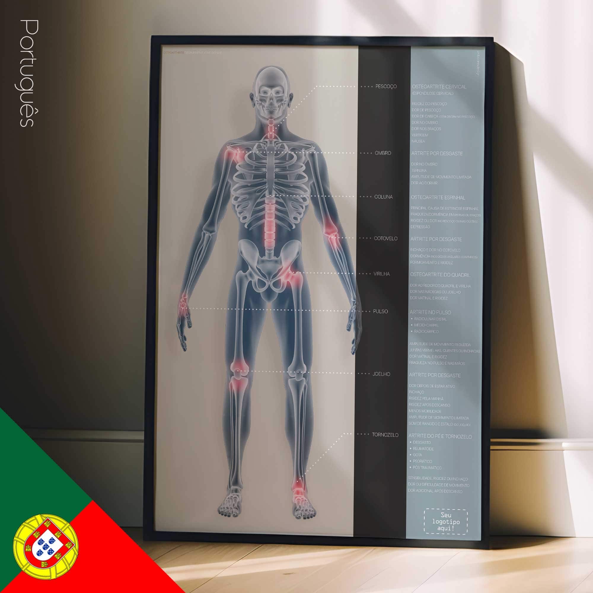 Osteoartrite. Opere d'arte di anatomia e fisiologia da educare.design