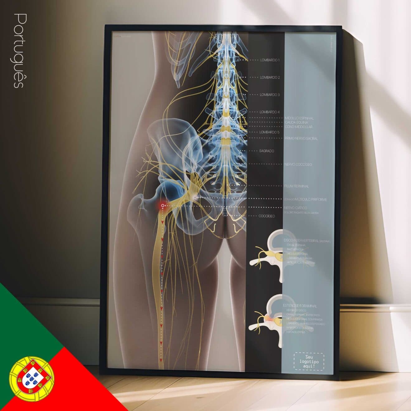Sciatica and stenosis artwork from educare.design