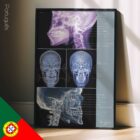 Disturbo dell'ATM. Opere d'arte di anatomia e fisiologia da educare.design
