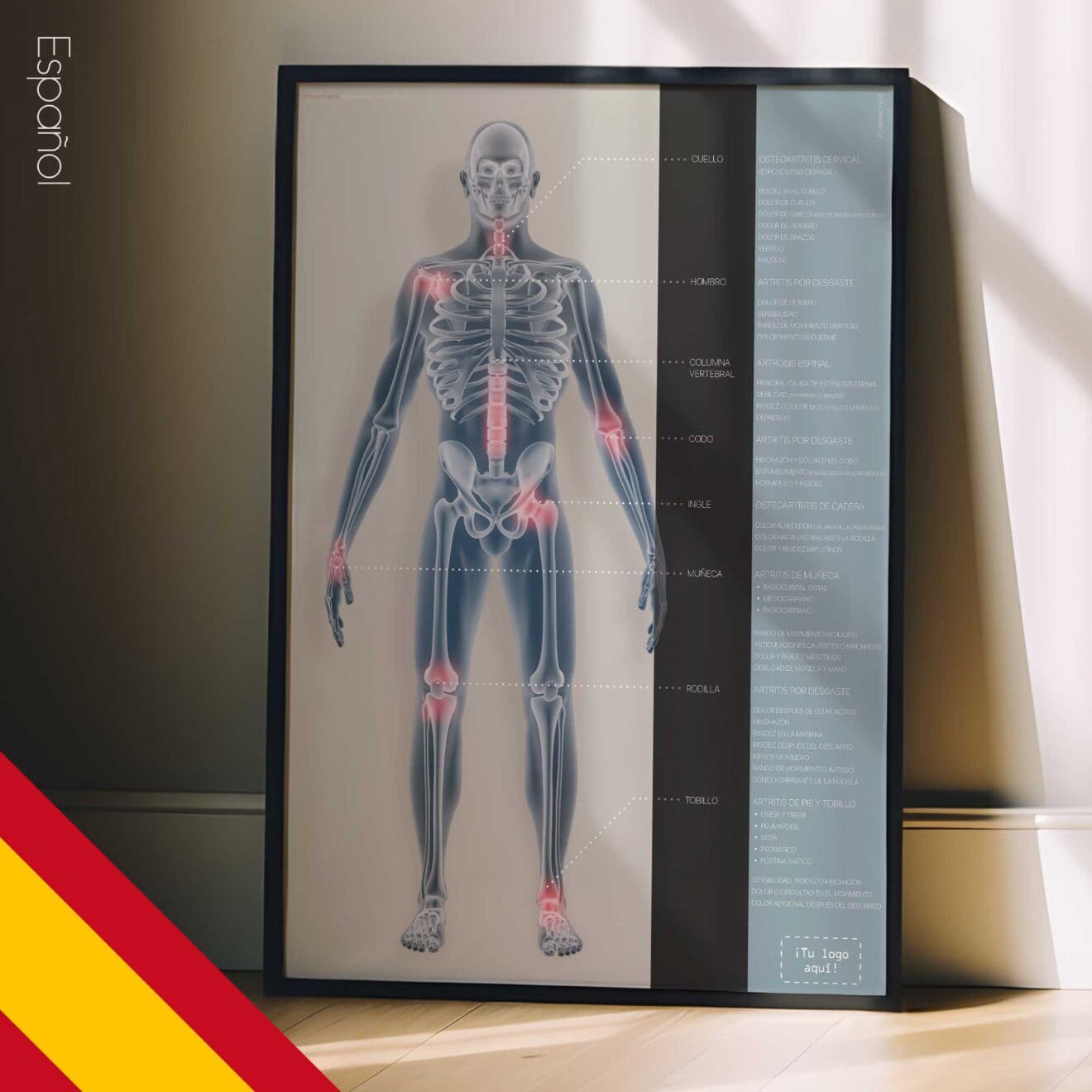 Osteoartritis