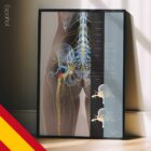 Ciática y Estenosis