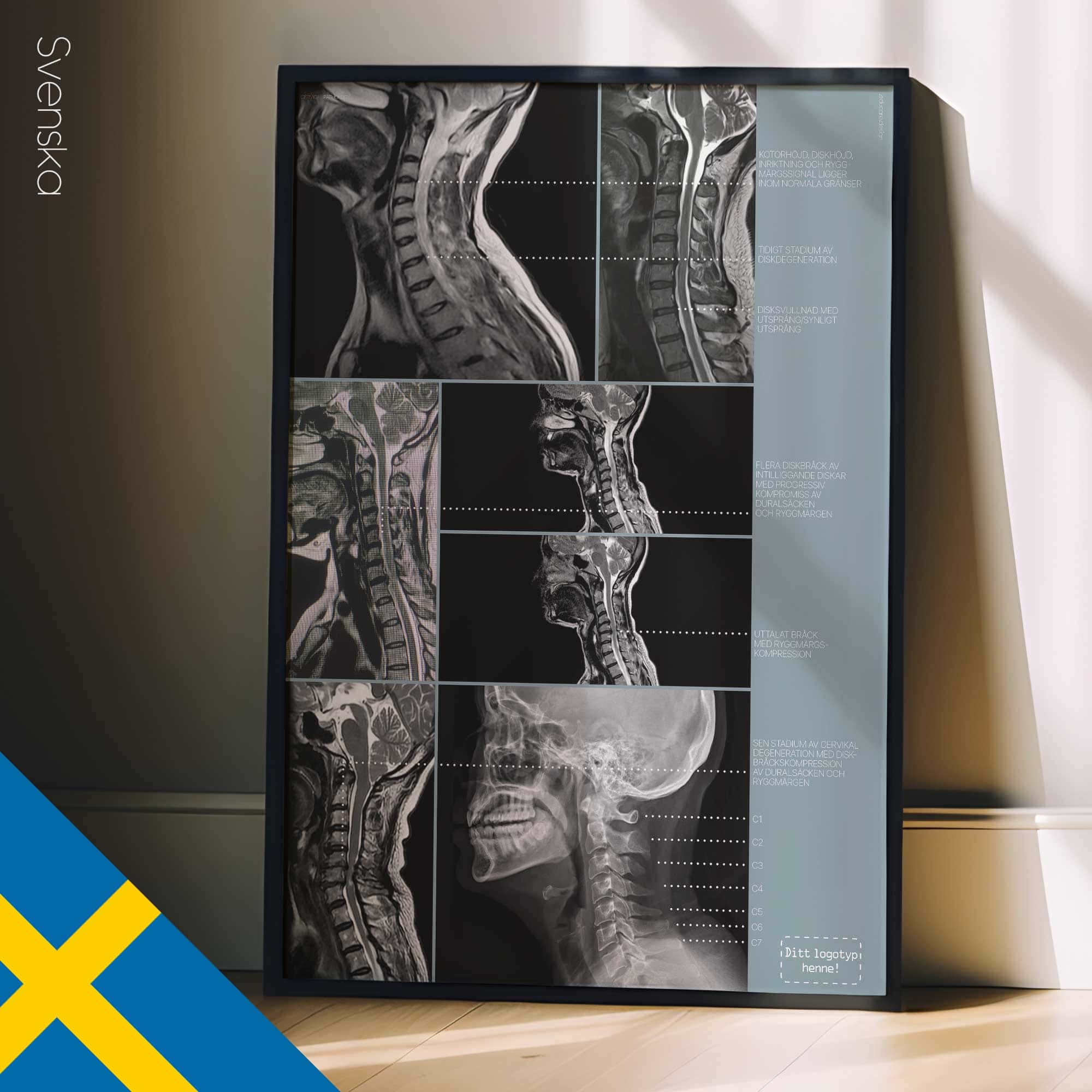 Cervical Pathology — Tavola anatomica