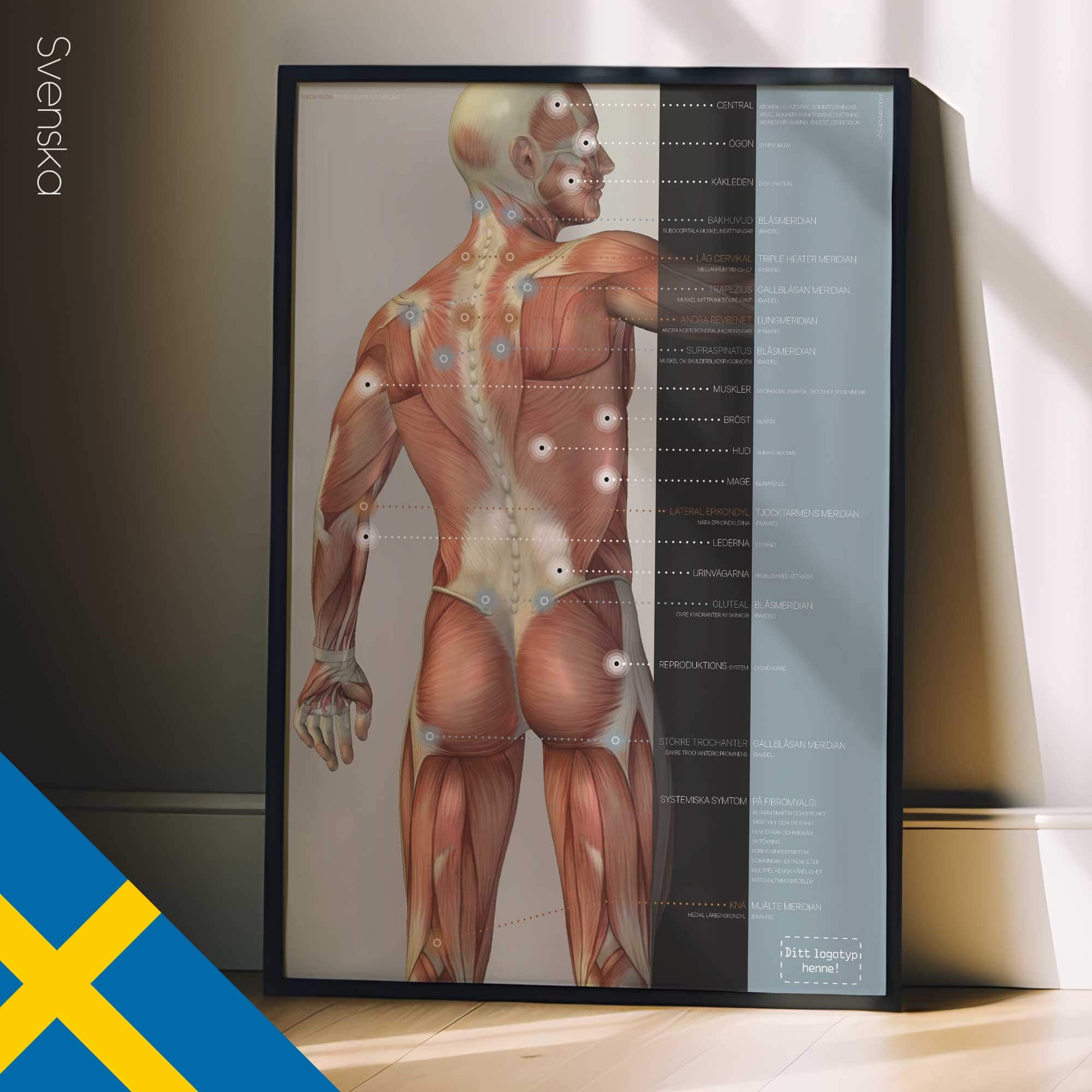 Fibromyalgia; Tender Points & Symptoms. Anatomy and physiology artwork from educare.design