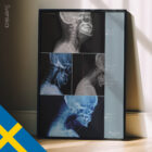 Postura della testa in avanti