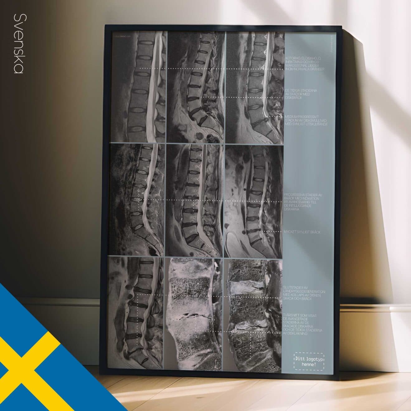 Opere d'arte sulla patologia lombare da educare.design