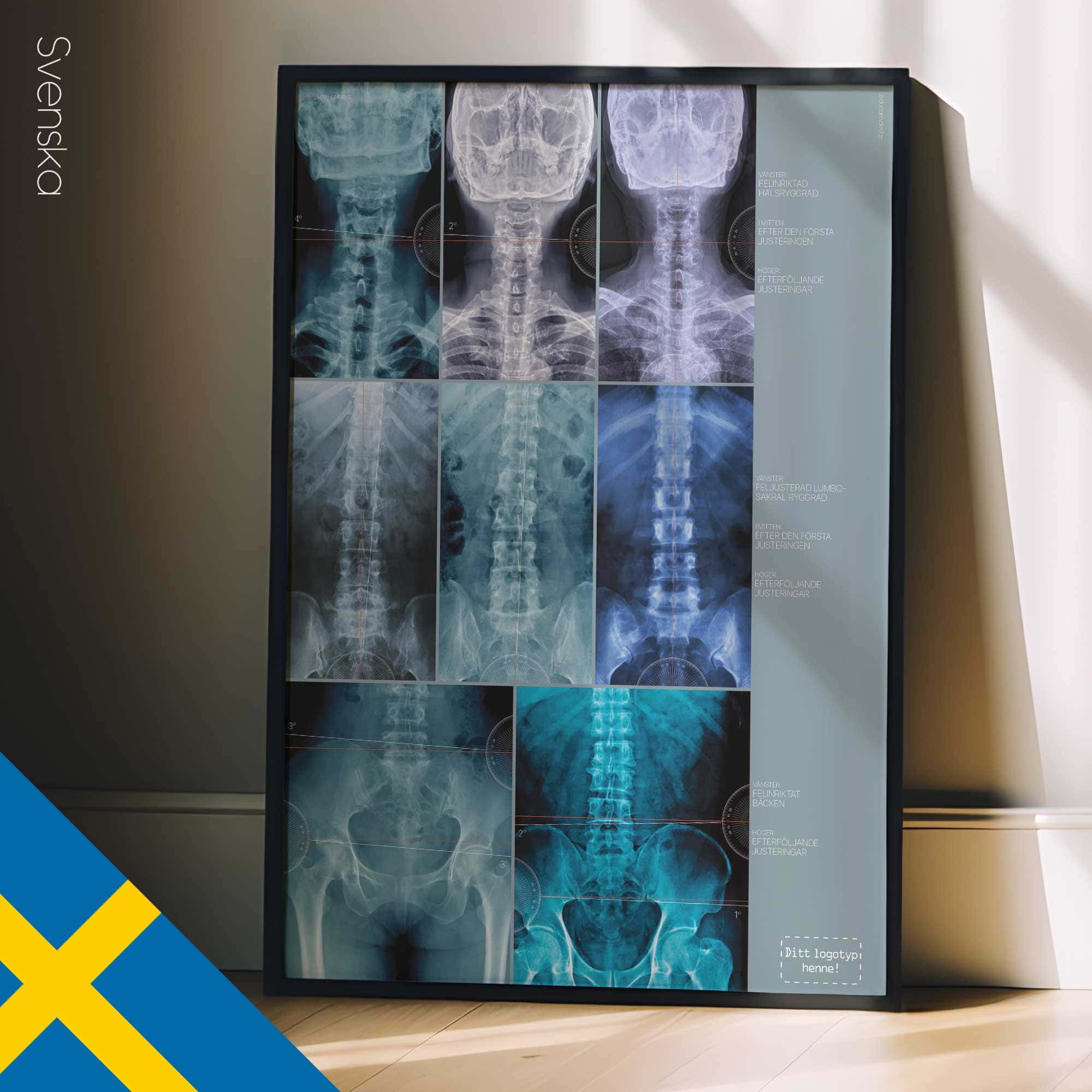 Fehlausrichtung, Anatomie und Physiologie - Kunstwerke von educare.design