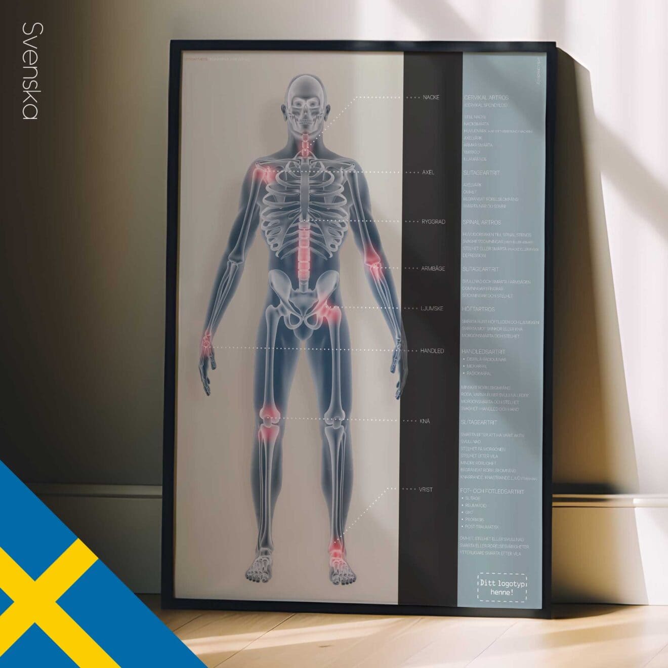 Arthrose. Dessin d'anatomie et de physiologie d'educare.design