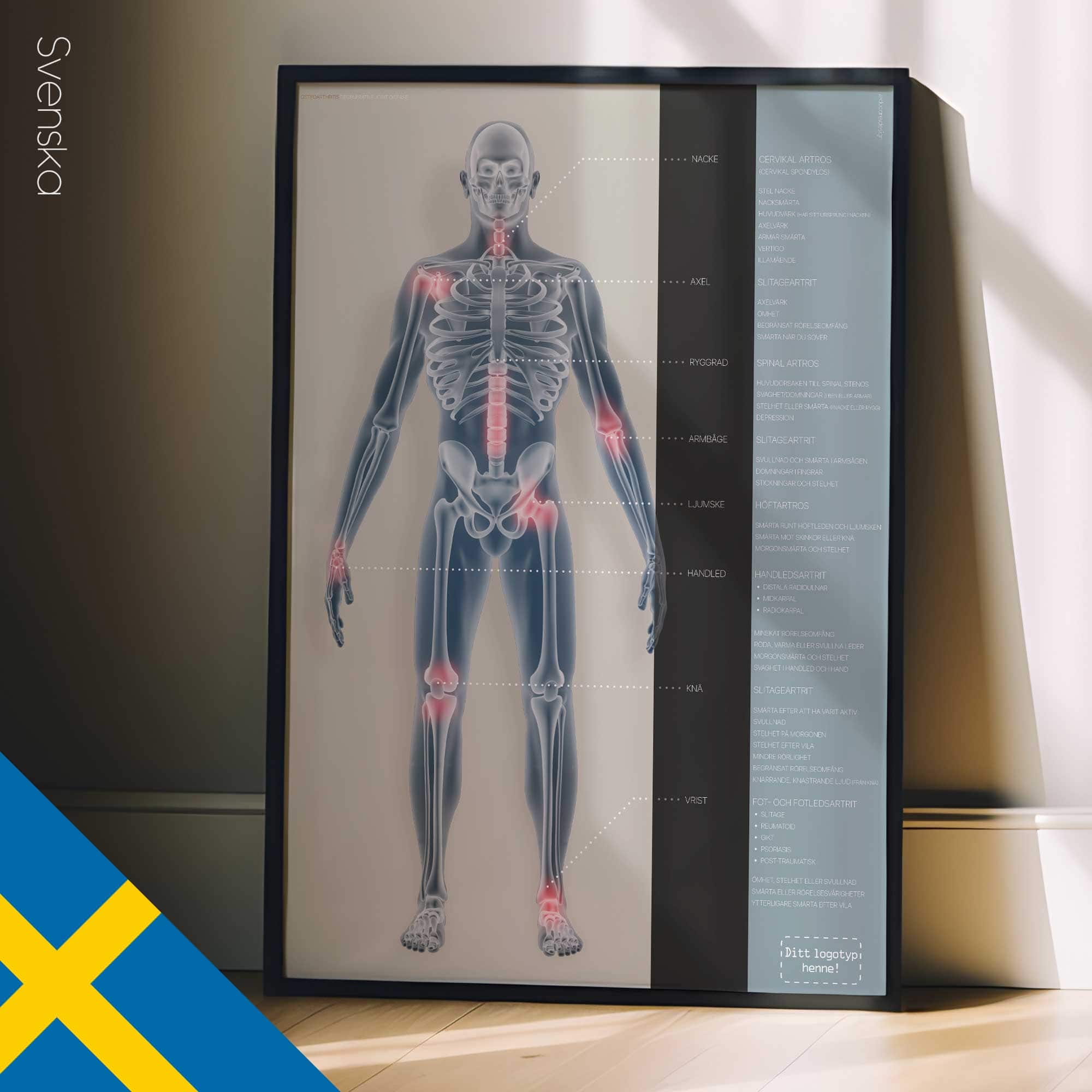 Osteoartrite. Opere d'arte di anatomia e fisiologia da educare.design