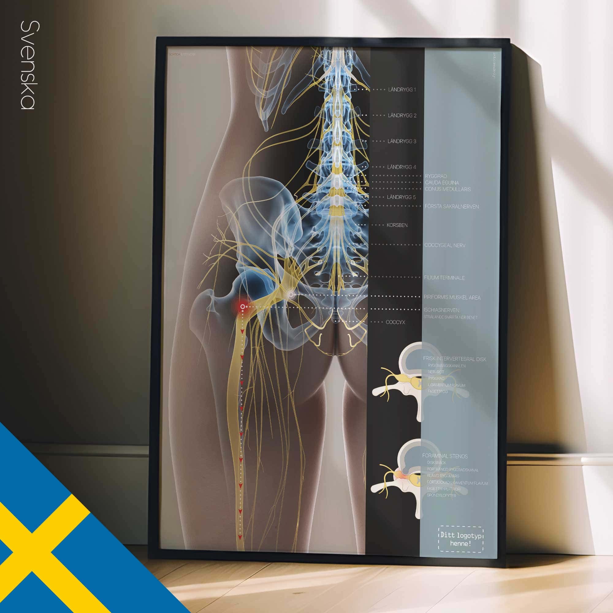 Sciatica and stenosis artwork from educare.design