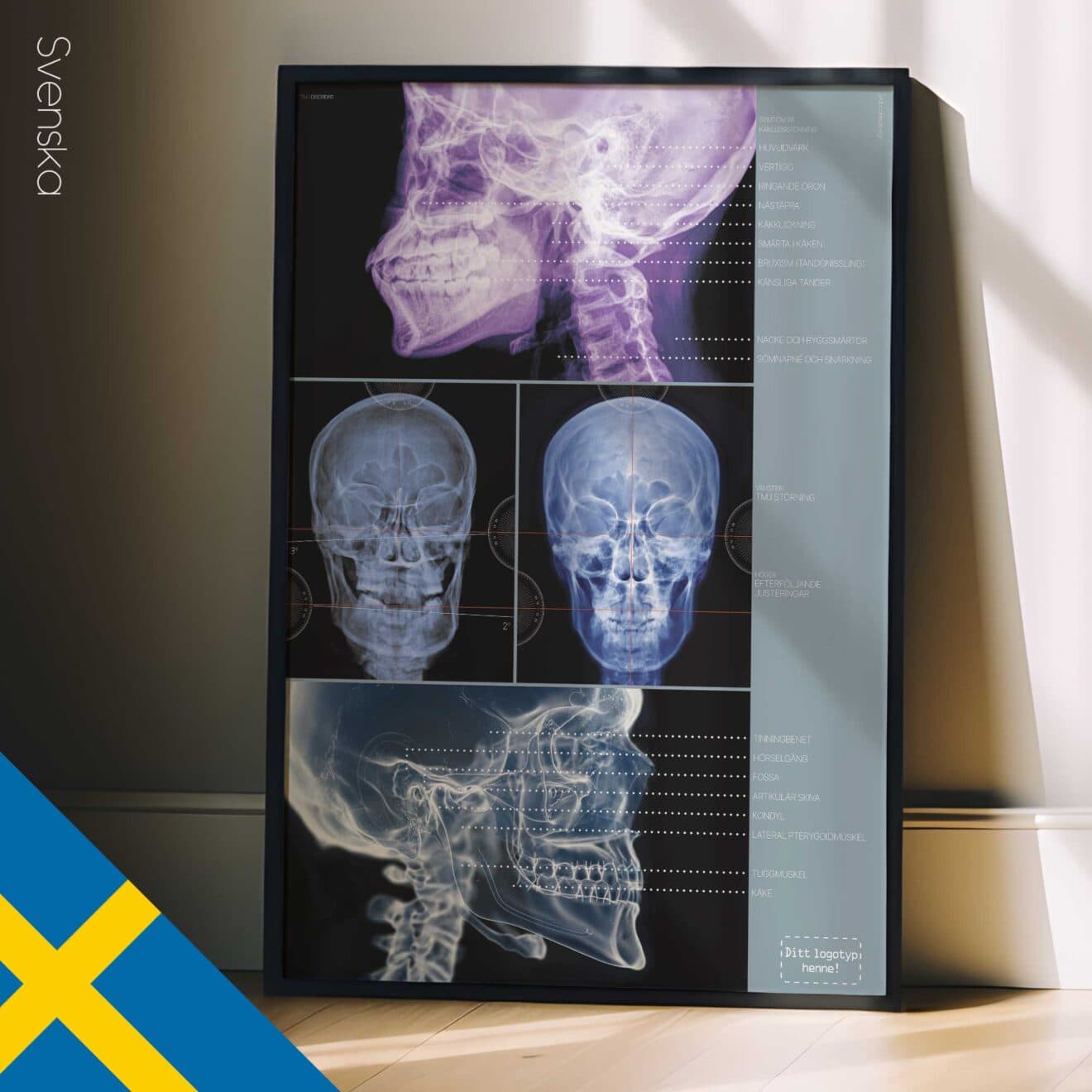 TMJ Disorder. Anatomy and physiology artwork from educare.design