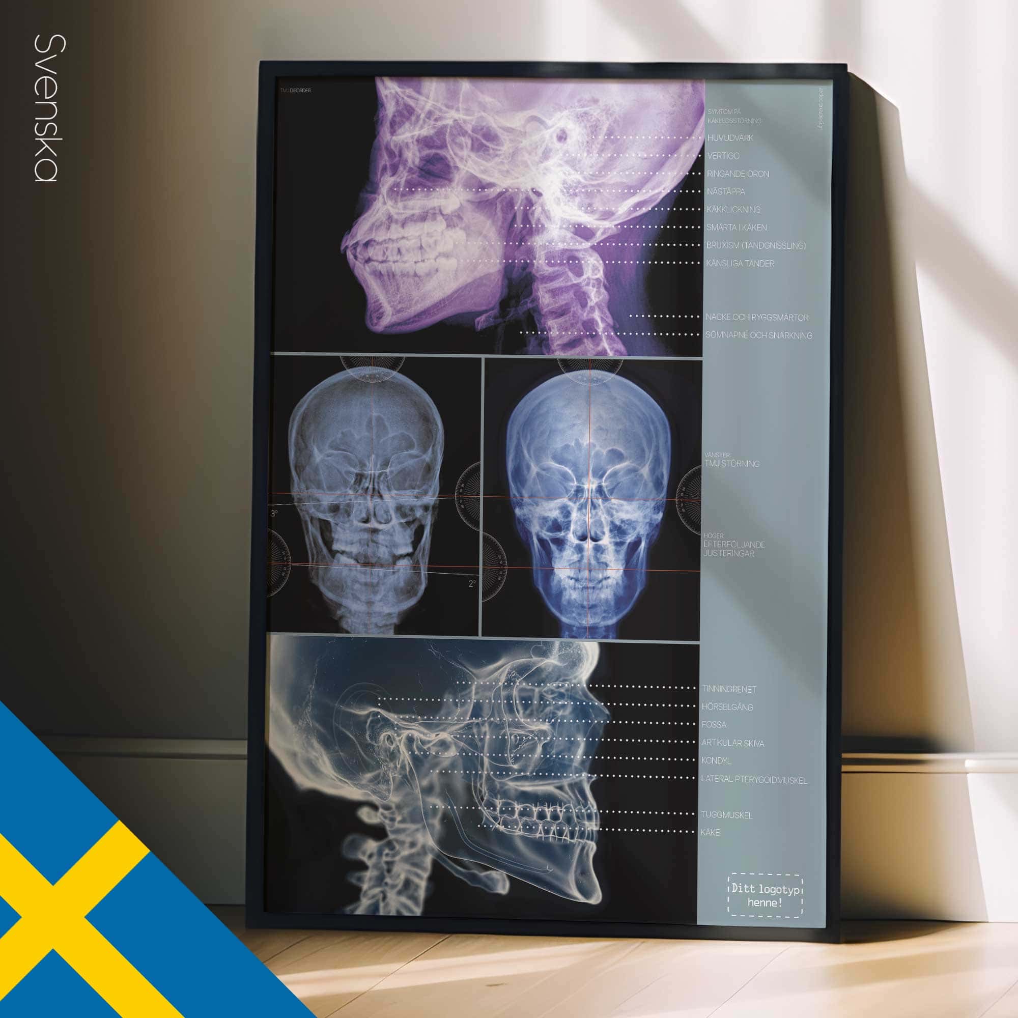 Disturbo dell'ATM. Opere d'arte di anatomia e fisiologia da educare.design