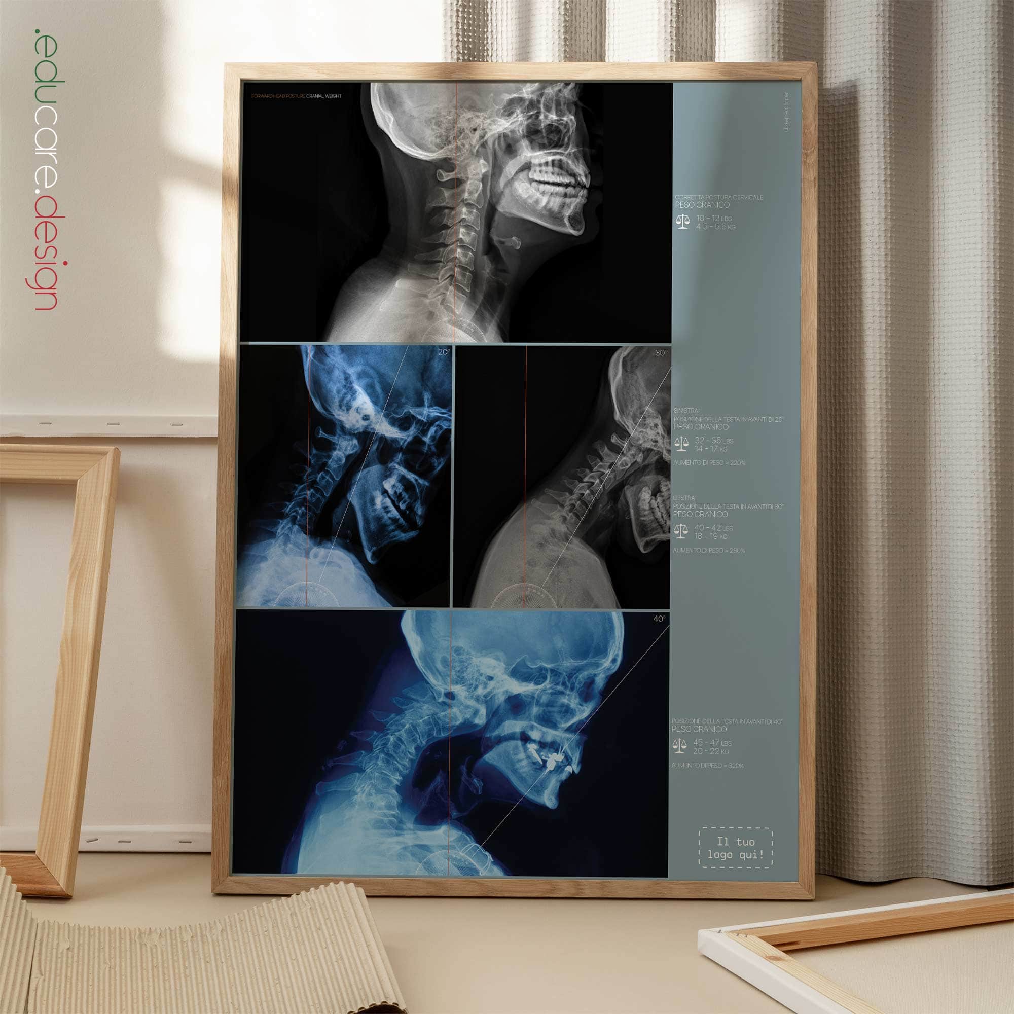 Postura della Testa in Avanti e Peso Craniale tavola anatomica per studi e cliniche