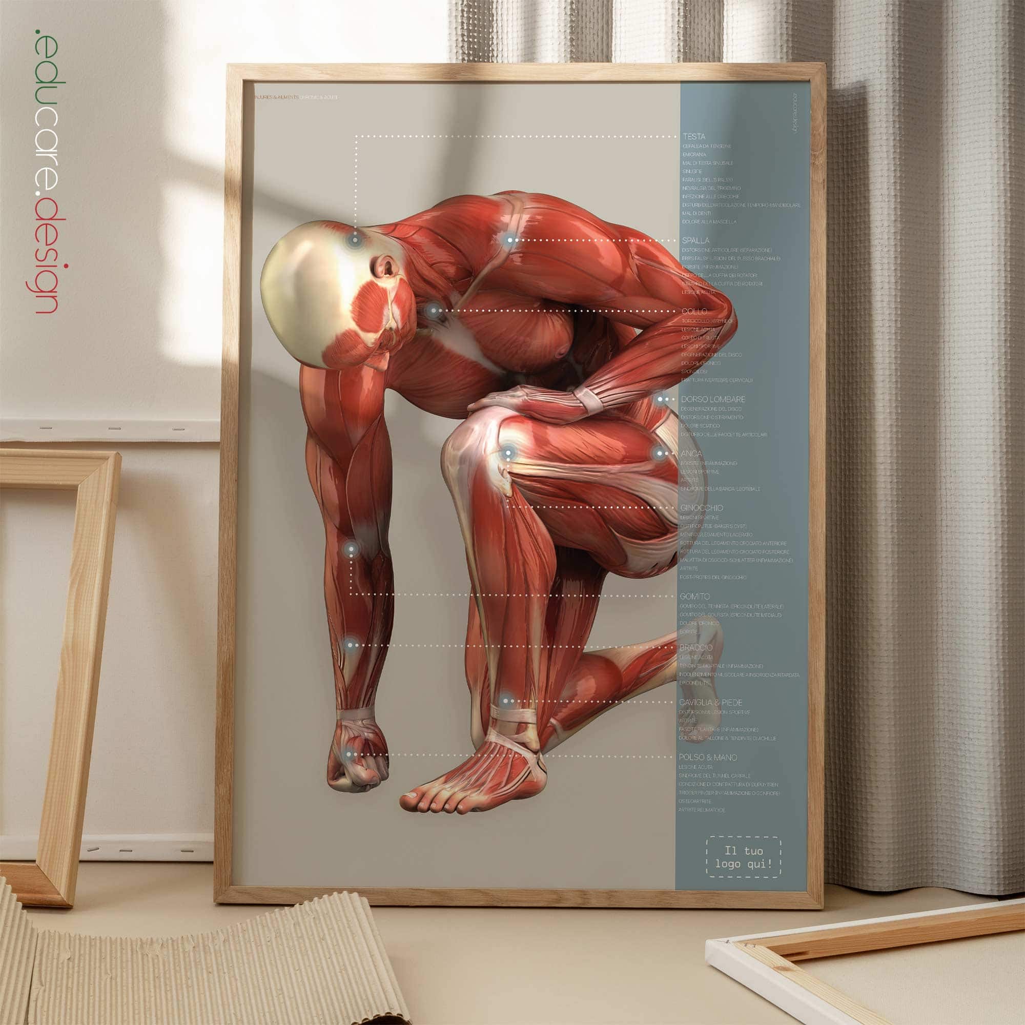 Lesioni e Disturbi Muscoloscheletrici Comuni tavola anatomica per studi e cliniche