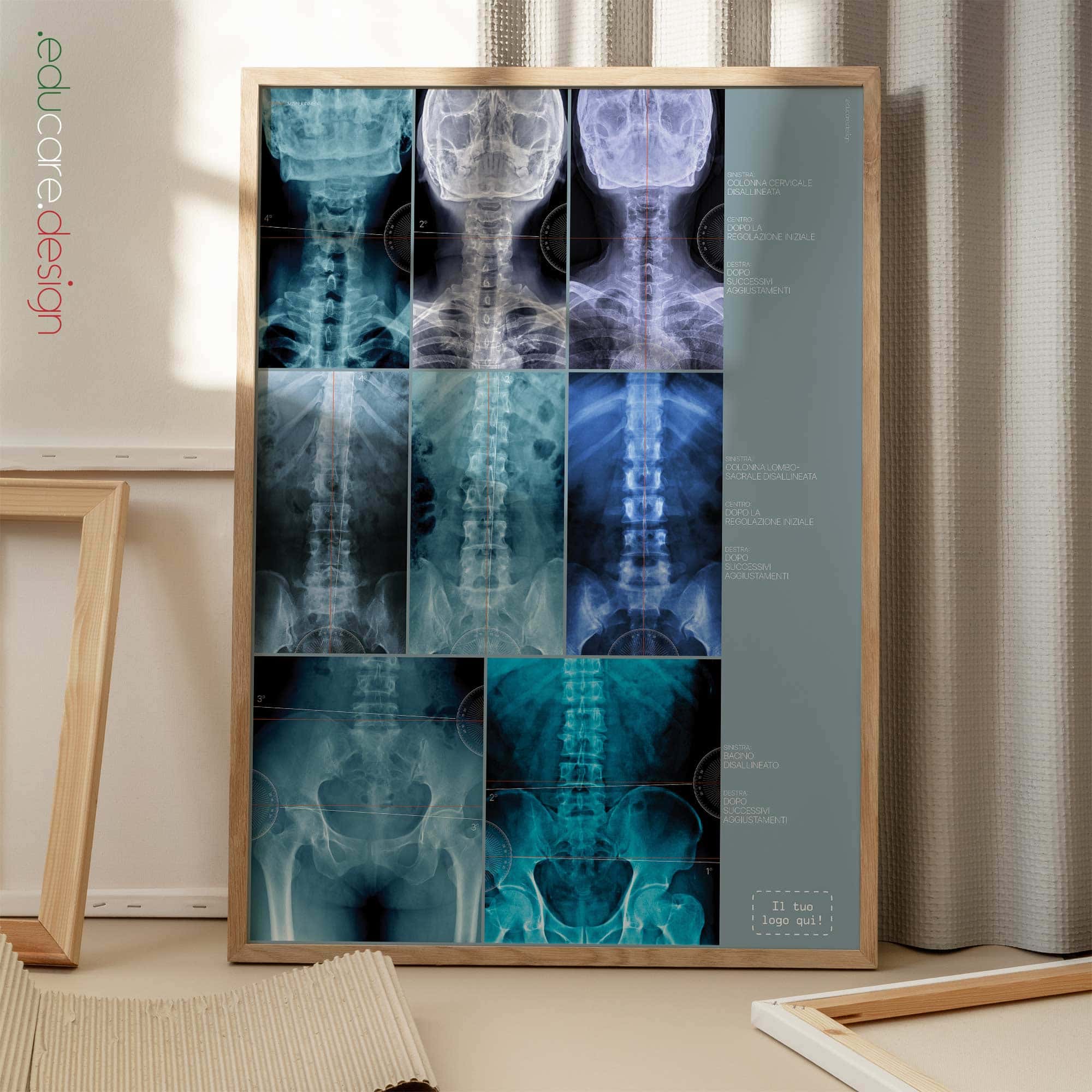 Disallineamento tavola anatomica per studi e cliniche