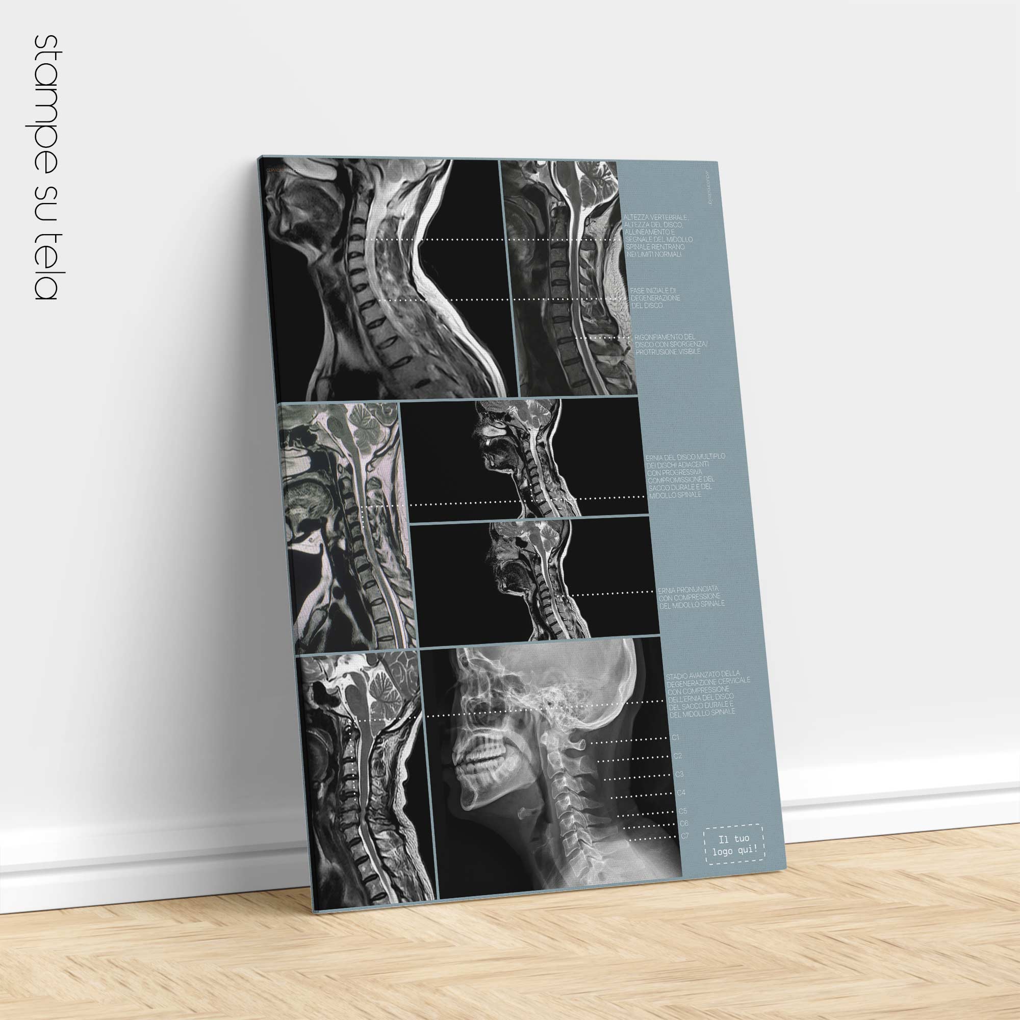 Opere d'arte sulla patologia cervicale da educare.design