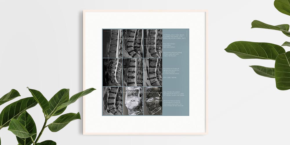 Pathologie lombaire artwork from educare.design