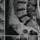 Patologia Lombare tavola anatomica per studi e cliniche Patologia Lombare tavola anatomica per studi e cliniche