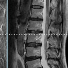 Patologia Lombare tavola anatomica per studi e cliniche Patologia Lombare tavola anatomica per studi e cliniche