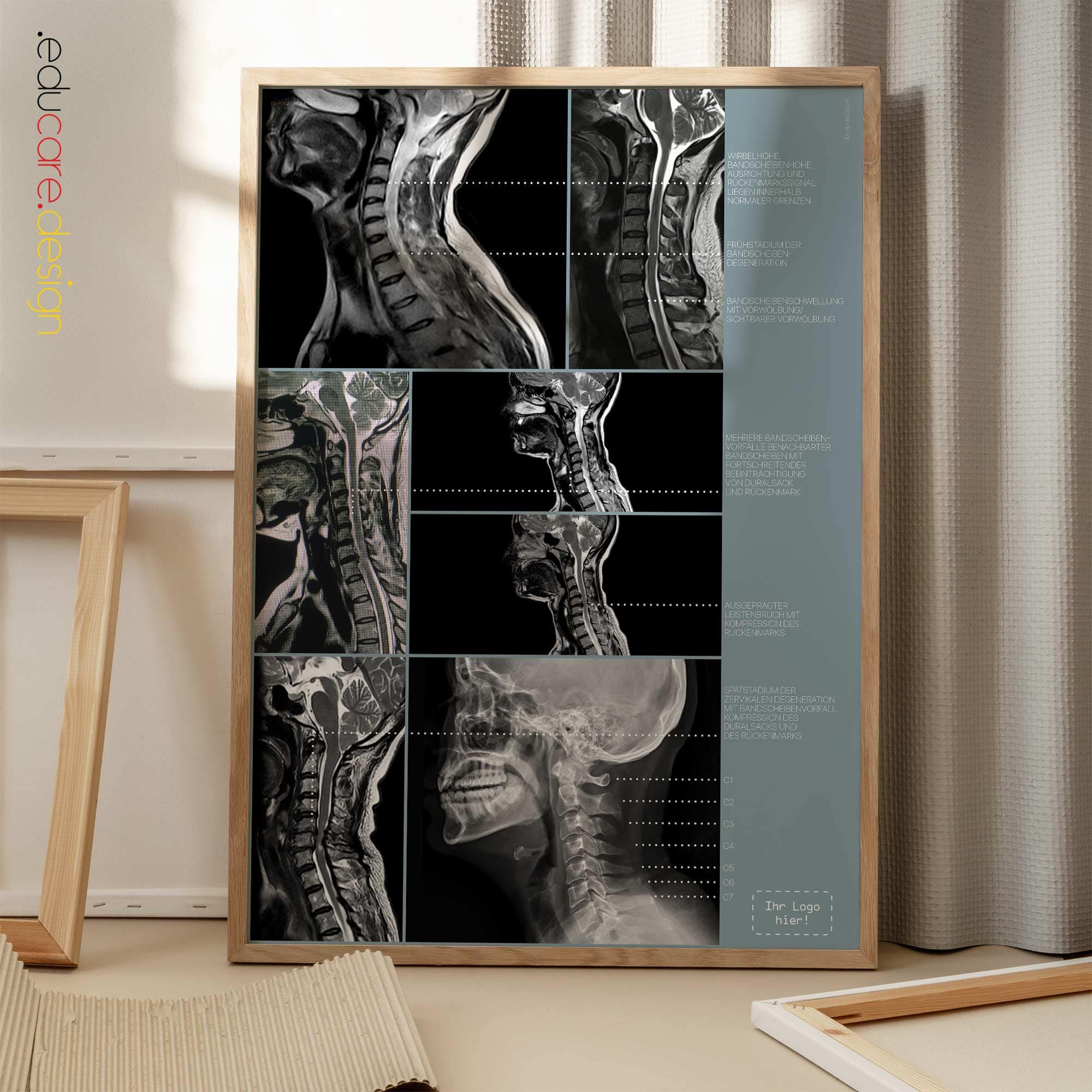 Zervikale Pathologie