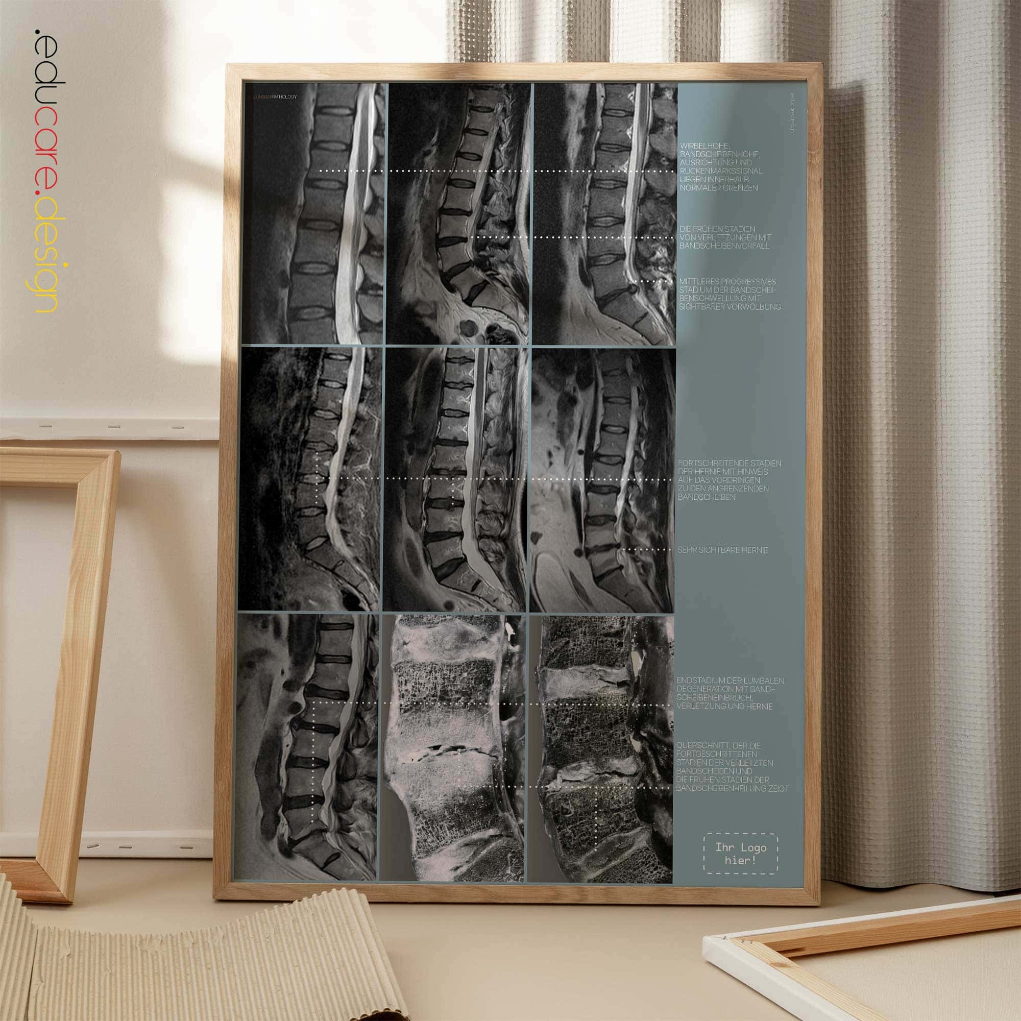 Lumbale Pathologie Anatomie-Chart für Praxen und Kliniken