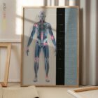Arthrose Anatomie-Chart für Praxen und Kliniken