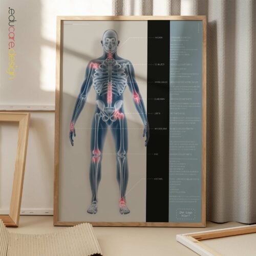 Bursitis, Arthritis und Tendinitis Anatomie-Chart für Praxen und Kliniken