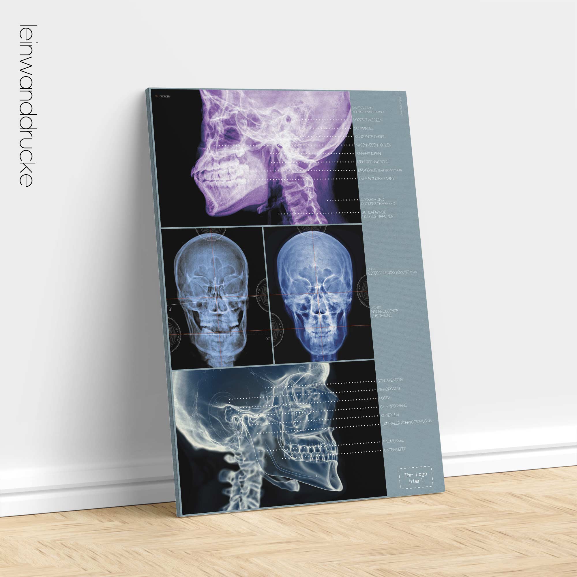 Kiefergelenk-Erkrankung. Anatomie und Physiologie Kunstwerke von educare.design