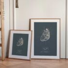 Heart anatomy, postural surface view