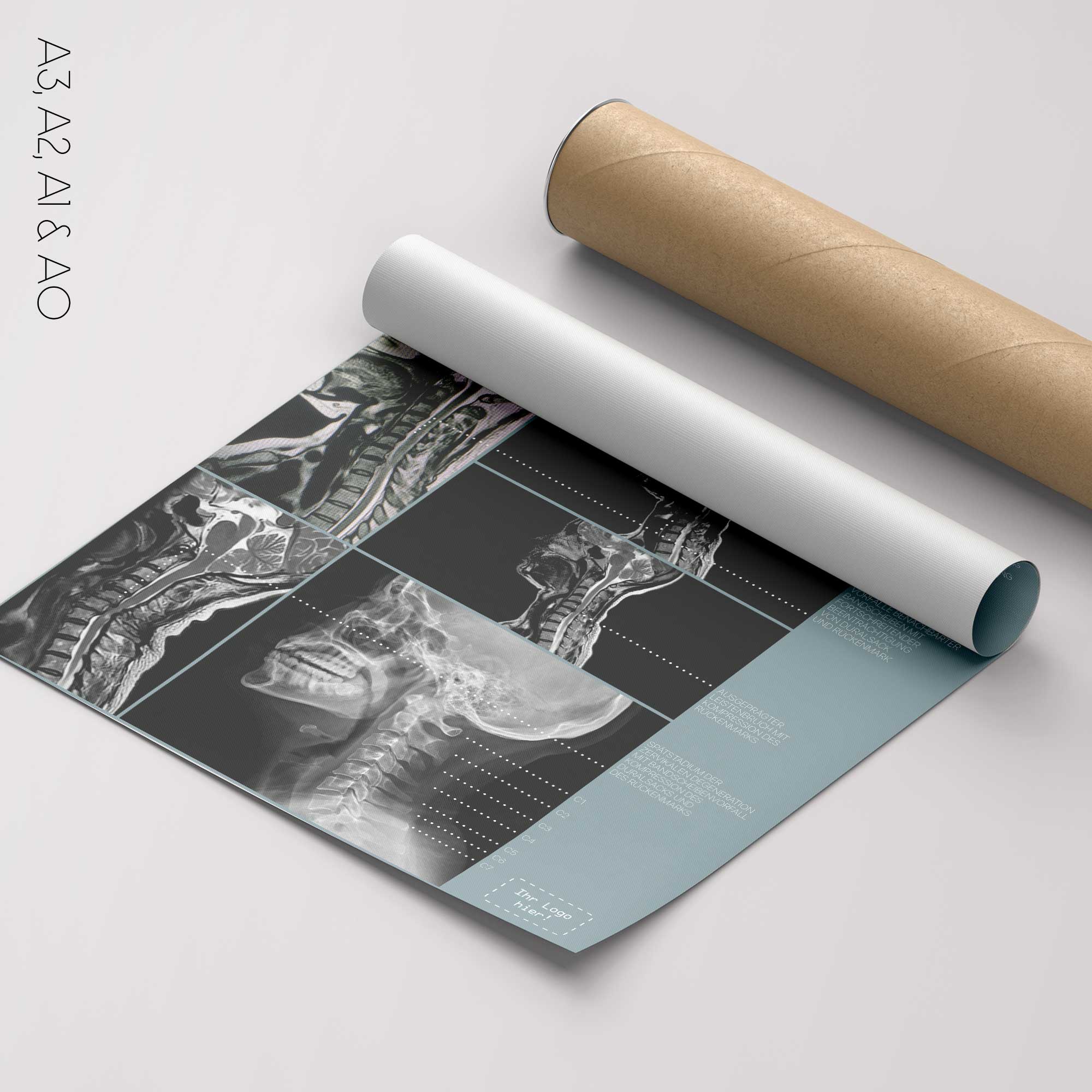 Zervikale Pathologie