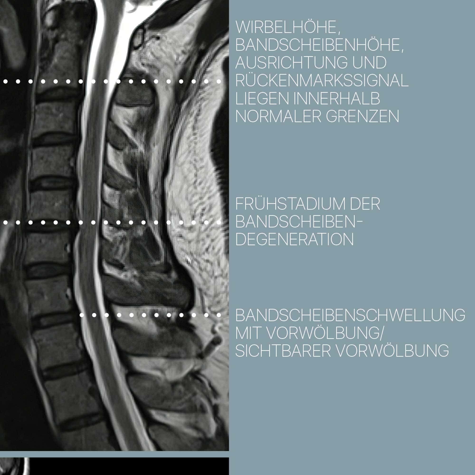 Zervikale Pathologie