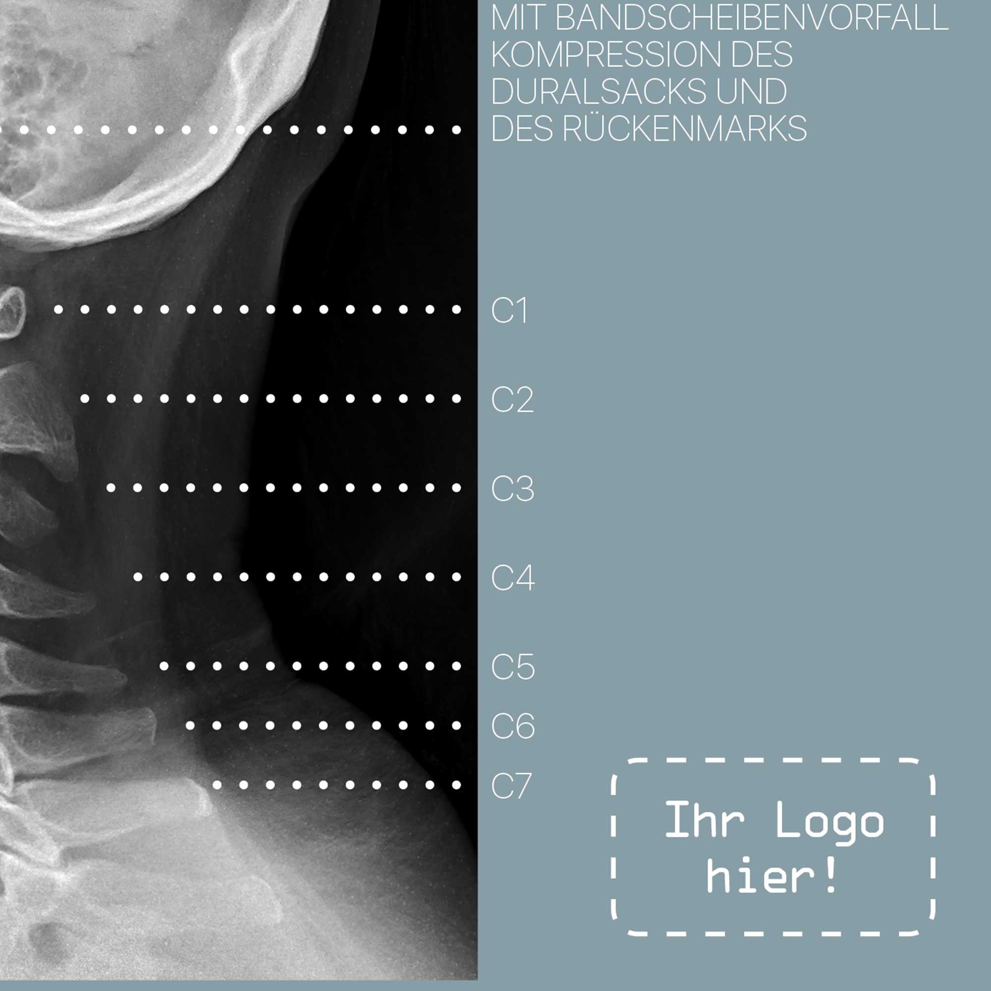 Zervikale Pathologie