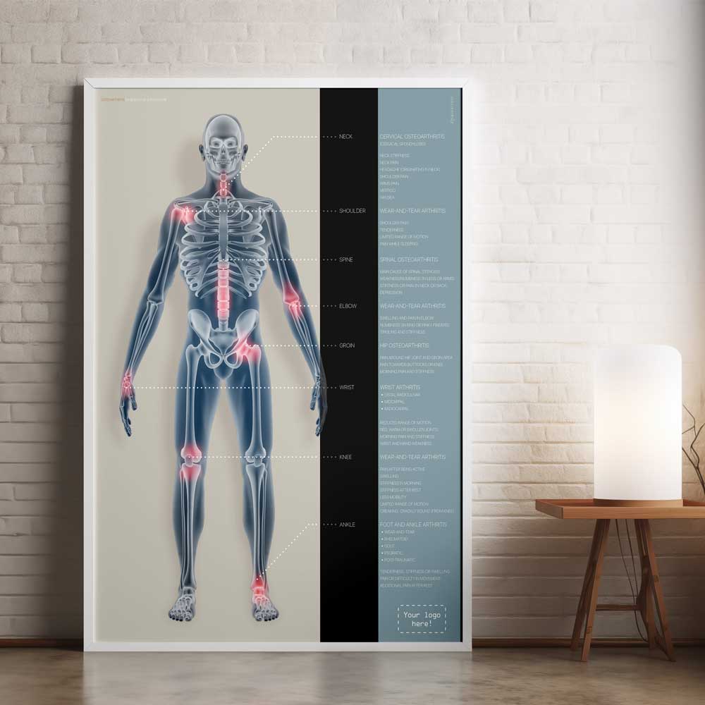 Osteoarthritis Artwork