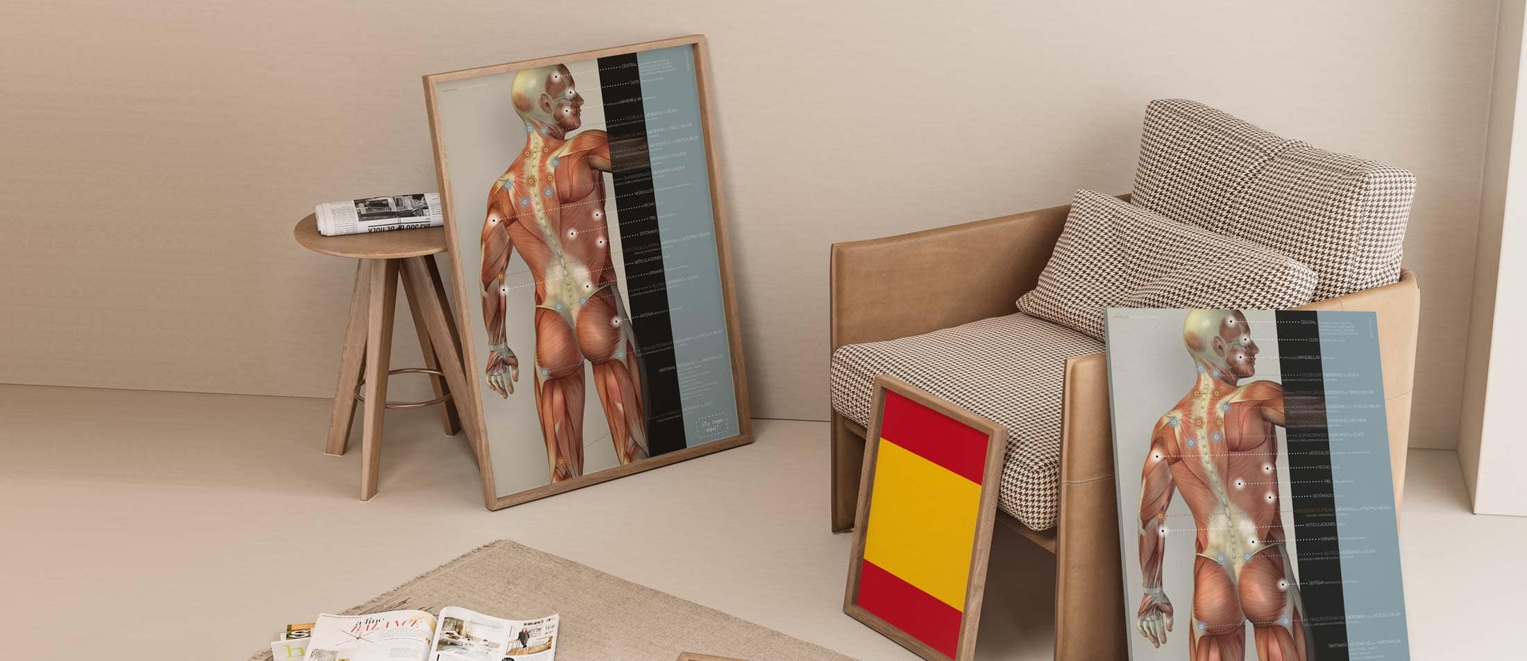 Fibromialgia; Puntos Sensibles y Síntomas