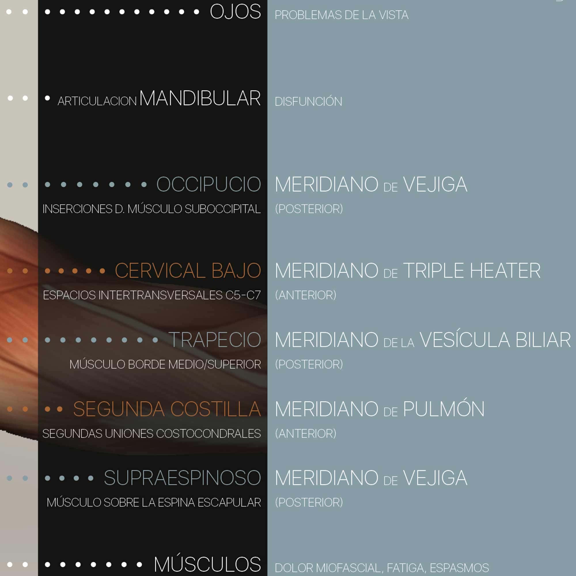 Fibromialgia; Puntos Sensibles y Síntomas