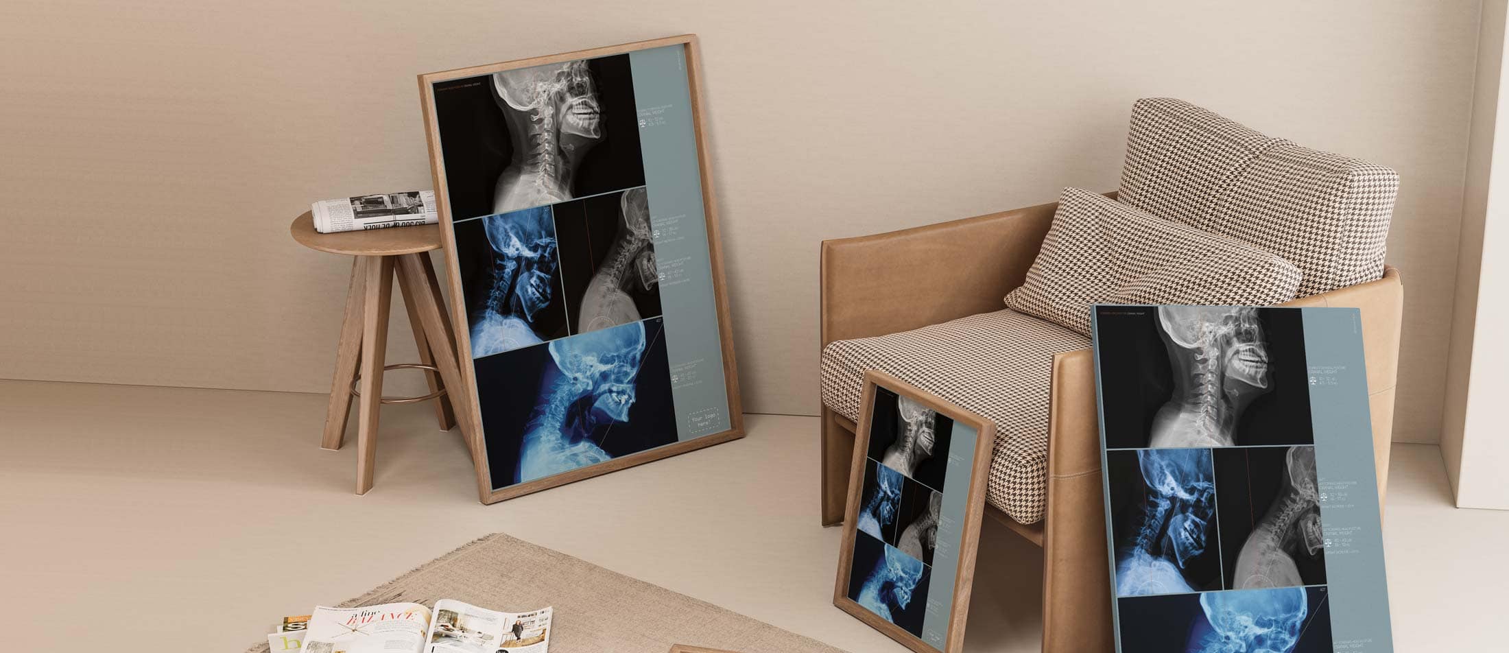 Forward Head Posture and Cranial Weight