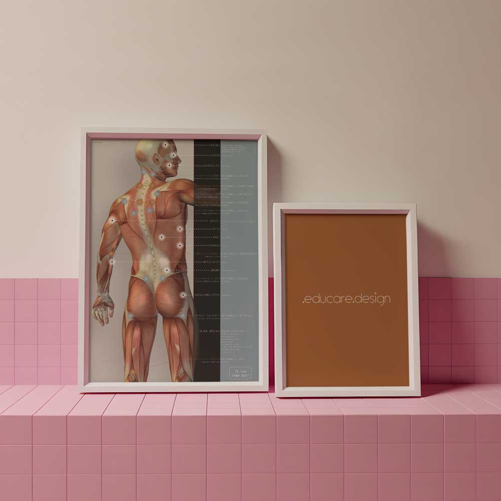 Fibromialgia; Punti teneri e sintomi