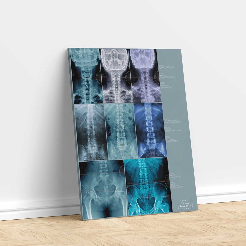 Misalignment Artwork