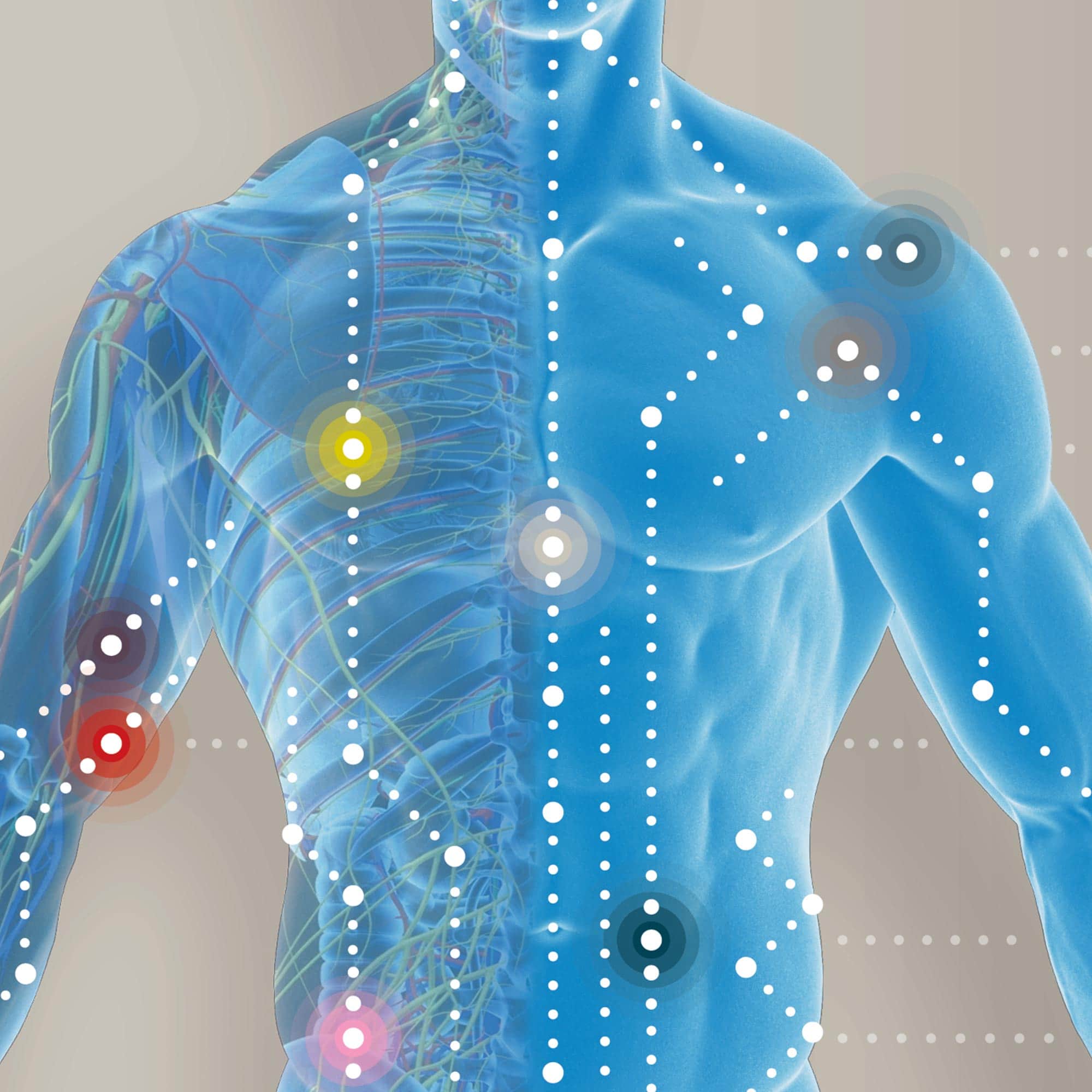 Fibromyalgia; Tender Points and Symptoms