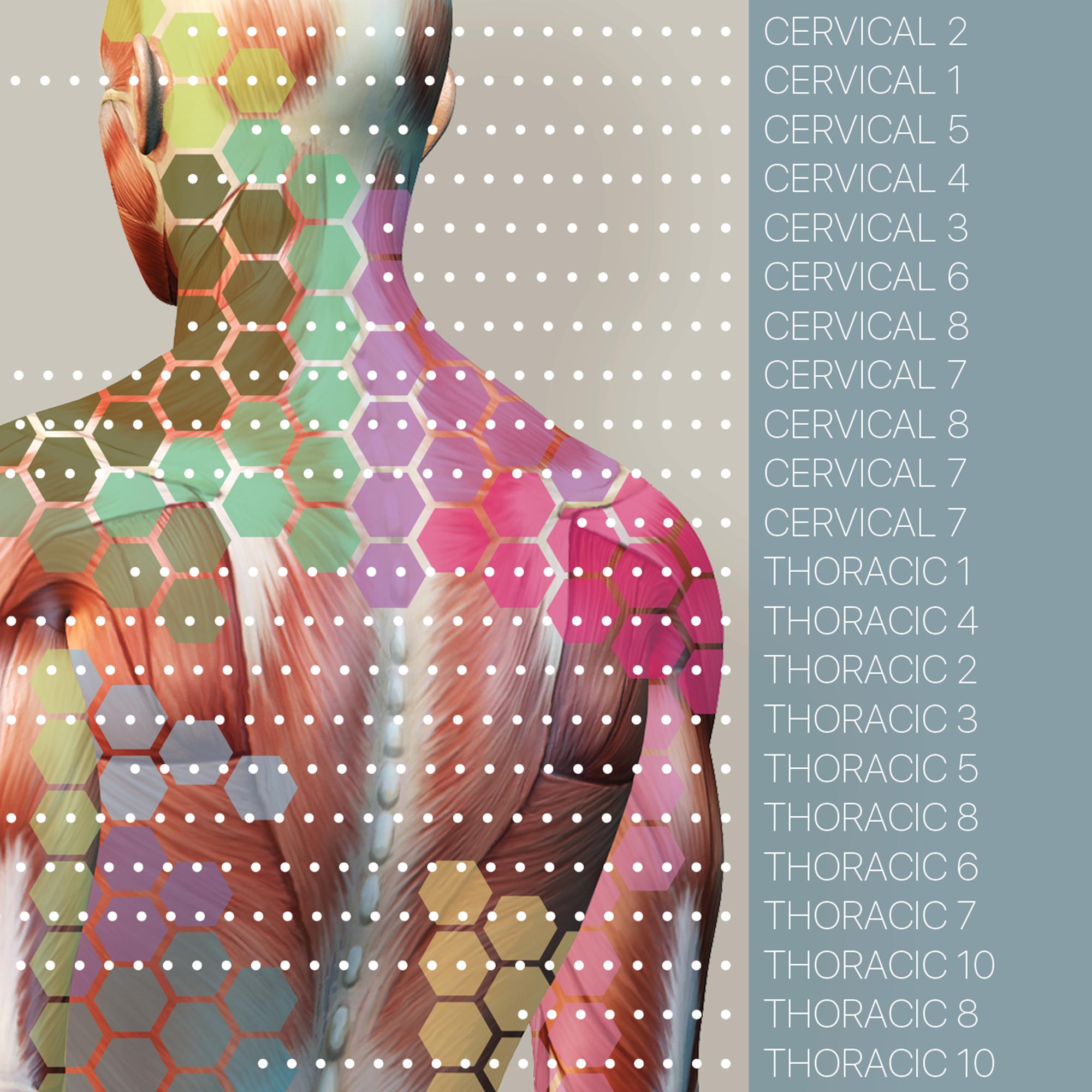 Sclerotomes Pain Map
