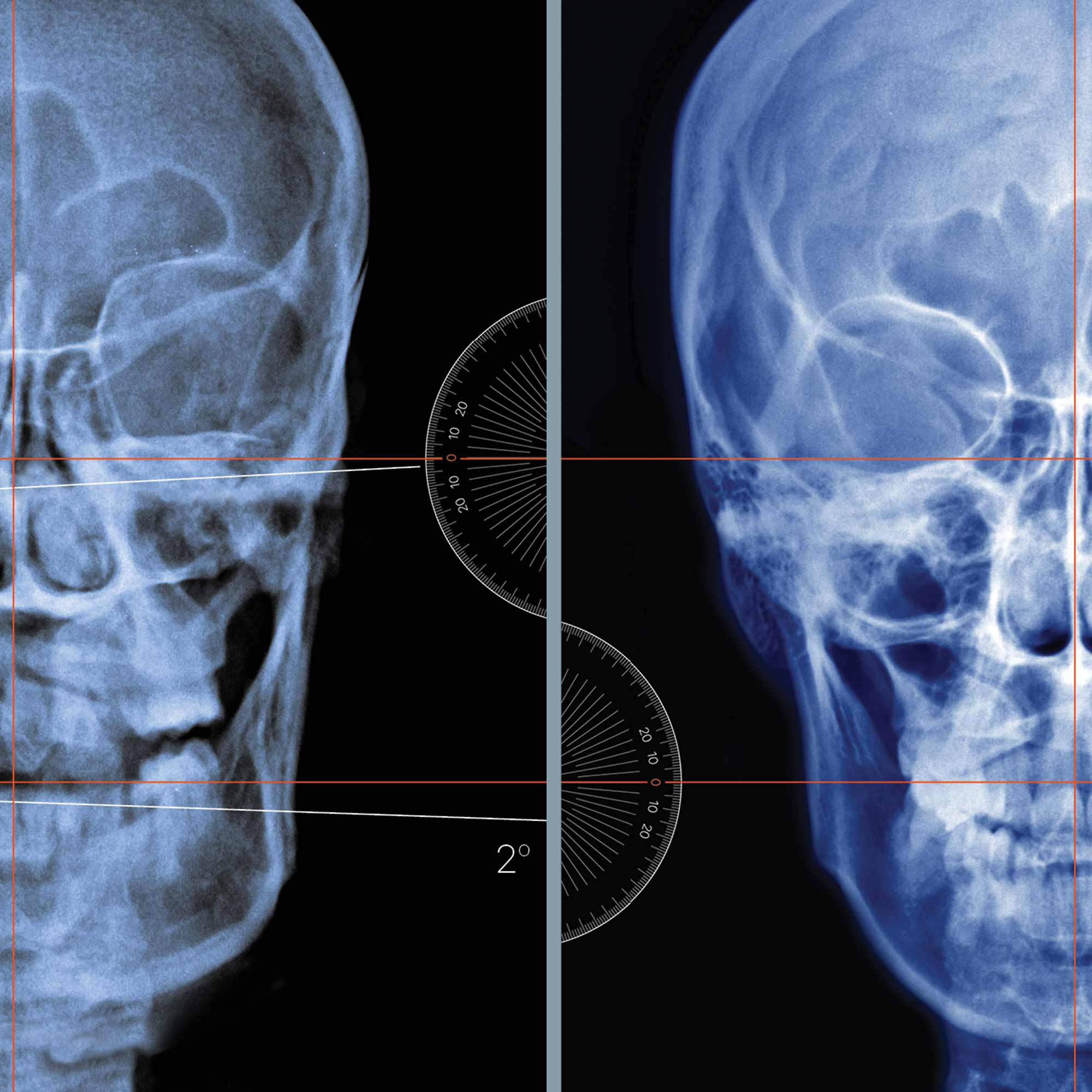 Male Reproductive System