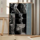 Pathologie Cervicale planche anatomique pour cabinets et cliniques